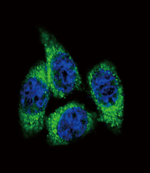 Confocal immunofluorescent of CYP17A1 Antibody with HeLa cell followed by Alexa Fluor 488-conjugated goat anti-rabbit lgG (green). DAPI was used to stain the cell nuclear (blue).
