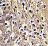 Formalin-fixed and paraffin-embedded human placenta tissue reacted with CYP19A1 antibody , which was peroxidase-conjugated to the secondary antibody, followed by DAB staining. This data demonstrates the use of this antibody for immunohistochemistry; clinical relevance has not been evaluated.