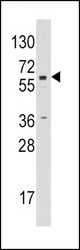 Western blot of anti-CYP19A1 antibody in Jurkat cell line lysates (35 ug/lane). CYP19A1 (arrow) was detected using the purified antibody.