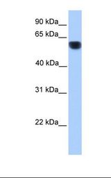 Fetal heart lysate. Antibody concentration: 1.0 ug/ml. Gel concentration: 12%.