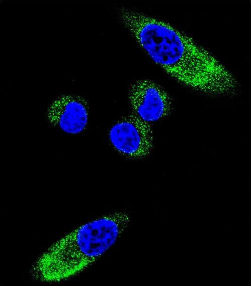Confocal immunofluorescent of CYP1A1 Antibody with MDA-MB231 cell followed by Alexa Fluor 488-conjugated goat anti-rabbit lgG (green). DAPI was used to stain the cell nuclear (blue).