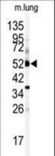 Western blot of anti-CYP1A1 Antibody in mouse lung tissue lysates (35 ug/lane). CYP1A1 (arrow) was detected using the purified antibody.
