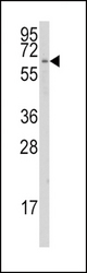 Western blot of anti-CYP1A1 Antibody in K562 cell line lysates (35 ug/lane). CYP1A1(arrow) was detected using the purified antibody.