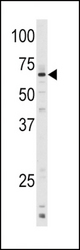 Western blot of anti-CYP1A1 Antibody in mouse lung tissue lysates (35 ug/lane). CYP1A1(arrow) was detected using the purified antibody.