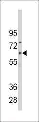 Western blot of anti-CYP1B1 Antibody in CEM cell line lysates (35 ug/lane). CYP1B1(arrow) was detected using the purified antibody.