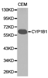 Western blot of extracts of CEM cell lines, using CYP1B1 antibody.