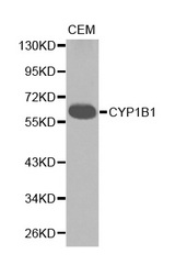 Western blot analysis of extracts of CEM cell lines, using CYP1B1 antibody.