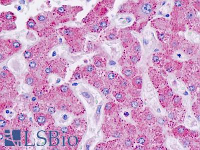 Anti-CYP21A2 antibody IHC staining of human liver. Immunohistochemistry of formalin-fixed, paraffin-embedded tissue after heat-induced antigen retrieval.
