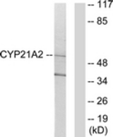 Western blot of extracts from 293 cells, using Cytochrome P450 21A2 Antibody. The lane on the right is treated with the synthesized peptide.
