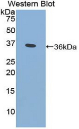 Western blot of recombinant CYP21A2.