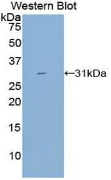 Western blot of recombinant CYP21A2.
