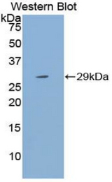 Western blot of recombinant CYP21A2.