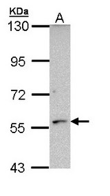 Sample (30 ug of whole cell lysate). A: Molt-4. 7.5% SDS PAGE. CYP21A2 antibody diluted at 1:1000.