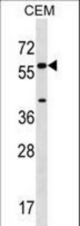 CYP21A2 Antibody western blot of CEM cell line lysates (35 ug/lane). The CYP21A2 antibody detected the CYP21A2 protein (arrow).
