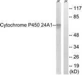 Western blot of extracts from Jurkat cells, using Cytochrome P450 24A1 Antibody. The lane on the right is treated with the synthesized peptide.
