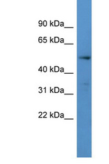 CYP24A1 / CYP24 antibody LS-C135726 Western blot of Placenta lysate. Antibody concentration 1 ug/ml.