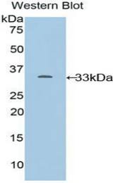 Western blot of recombinant CYP24 / CYP24A1.