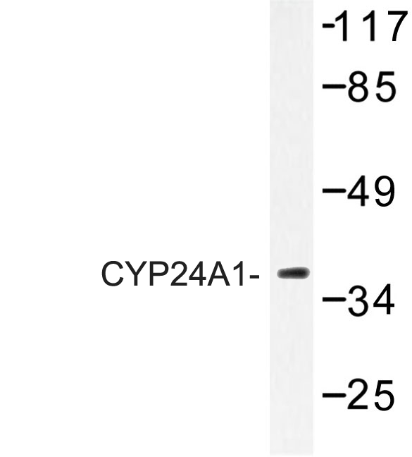 Western blot of CYP24A1 (R439) pAb in extracts from HUVEC cells.