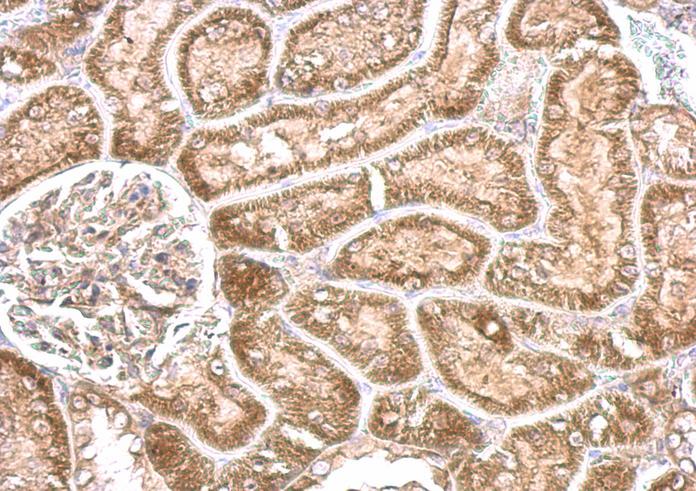CYP24A1 antibody detects CYP24A1 protein at cytosol on mouse kidney by immunohistochemical analysis. Sample: Paraffin-embedded mouse kidney. CYP24A1 antibody dilution:1:500.
