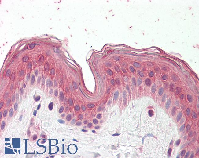 Anti-CYP24 / CYP24A1 antibody IHC staining of human skin. Immunohistochemistry of formalin-fixed, paraffin-embedded tissue after heat-induced antigen retrieval.