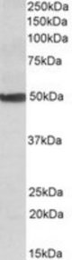 CYP24A1 antibody (0.1 ug/ml) staining of Human Liver lysate (35 ug protein/ml in RIPA buffer). Primary incubation was 1 hour. Detected by chemiluminescence.