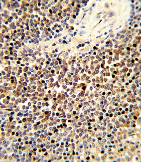 Formalin-fixed and paraffin-embedded human spleen tissue reacted with CYP24A1 Antibody , which was peroxidase-conjugated to the secondary antibody, followed by DAB staining. This data demonstrates the use of this antibody for immunohistochemistry; clinical relevance has not been evaluated.