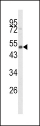 Western blot of CYP24A1 Antibody in mouse spleen tissue lysates (35 ug/lane). CYP24A1 (arrow) was detected using the purified antibody.