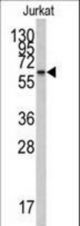 Western blot of anti-CYP26A1 Antibody in Jurkat cell line lysates (35 ug/lane). CYP26A1(arrow) was detected using the purified antibody.