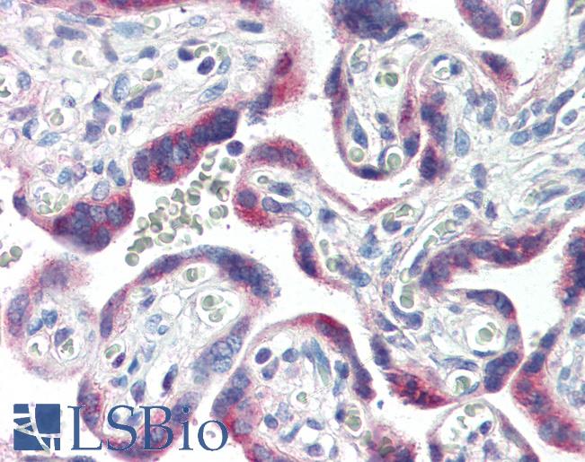 Anti-CYP26A1 antibody IHC of human placenta. Immunohistochemistry of formalin-fixed, paraffin-embedded tissue after heat-induced antigen retrieval. Antibody LS-B2916 concentration 10 ug/ml.