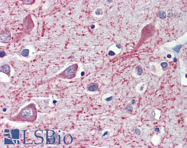 Anti-CYP26A1 antibody IHC of human brain, cortex. Immunohistochemistry of formalin-fixed, paraffin-embedded tissue after heat-induced antigen retrieval. Antibody LS-B4140 concentration 3.75 ug/ml.
