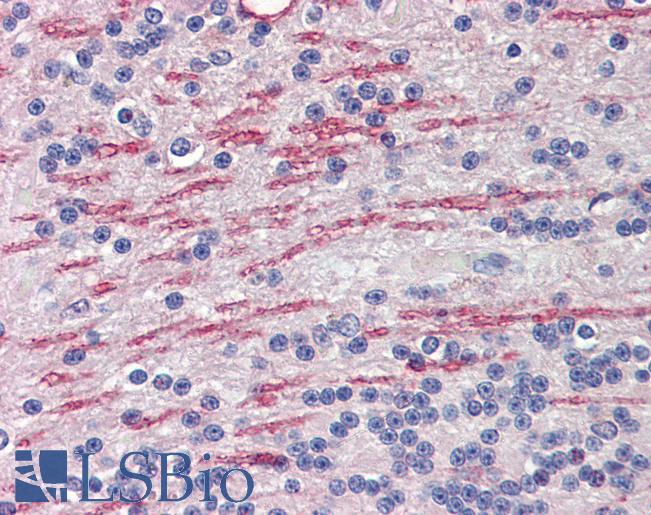 Anti-CYP26A1 antibody IHC of human brain, cerebellum, white matter. Immunohistochemistry of formalin-fixed, paraffin-embedded tissue after heat-induced antigen retrieval. Antibody LS-B4140 concentration 3.75 ug/ml.