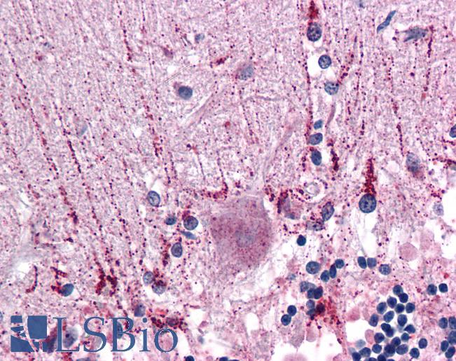 Anti-CYP26B1 antibody IHC of human brain, cerebellum. Immunohistochemistry of formalin-fixed, paraffin-embedded tissue after heat-induced antigen retrieval. Antibody LS-B4833 concentration 10 ug/ml.