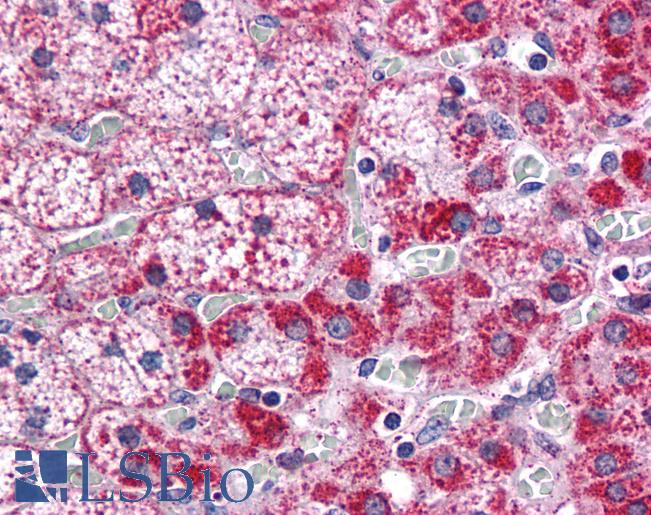 Anti-CYP26B1 antibody IHC of human adrenal. Immunohistochemistry of formalin-fixed, paraffin-embedded tissue after heat-induced antigen retrieval. Antibody LS-B4833 concentration 10 ug/ml.