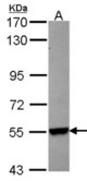 Sample (30 ug of whole cell lysate). A: Hep G2. 7.5% SDS PAGE. CYP26B1 antibody diluted at 1:1000.