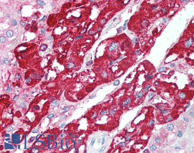 Anti-CHGA / Chromogranin A antibody IHC of human adrenal. Immunohistochemistry of formalin-fixed, paraffin-embedded tissue after heat-induced antigen retrieval. Antibody LS-B1515 concentration 5 ug/ml.