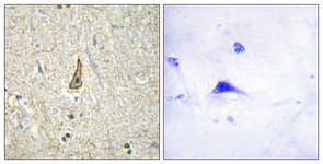 IHC of paraffin-embedded human brain, using Cytochrome P450 26C1 Antibody. The picture on the right is treated with the synthesized peptide.