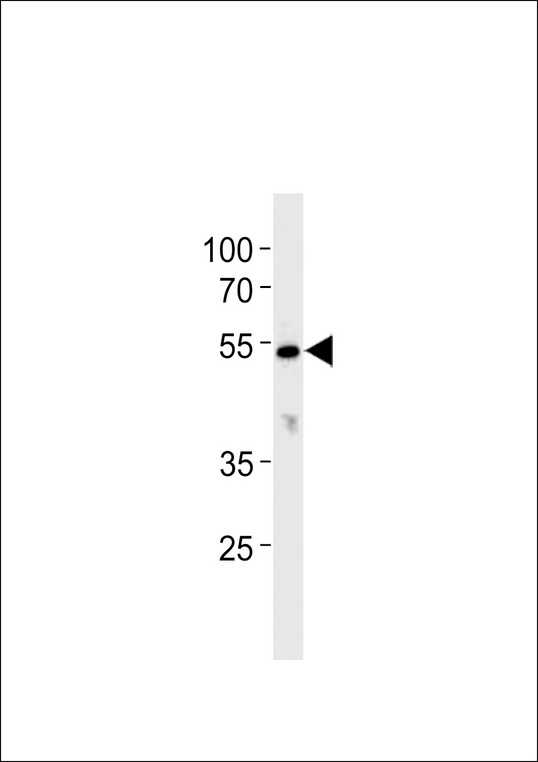 CYP26C1 Antibody western blot of K562 cell line lysates (35 ug/lane). The CYP26C1 antibody detected the CYP26C1 protein (arrow).