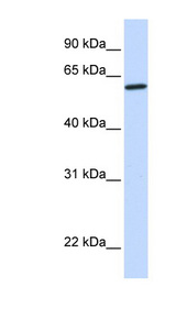 CYP27A1 antibody LS-C102397 Western blot of Fetal Brain lysate.
