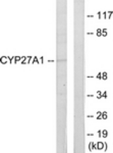 Western blot of extracts from HeLa cells, using Cytochrome P450 27A1 Antibody. The lane on the right is treated with the synthesized peptide.