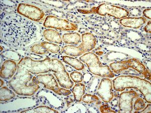 IHC of paraffin-embedded human kidney tissue using anti-CYP27A1 antibody.