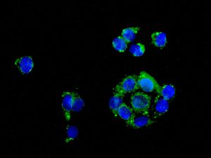 Immunofluorescent staining of HepG2 cells using anti-CYP27A1 antibody.