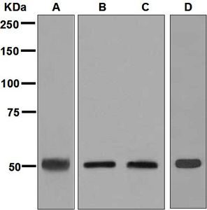 Western blot analysis on (A) HepG2, (B) Caco-2, (C) fetal liver, and (D) mouse liver lysates using anti-CYP27A1 antibody.