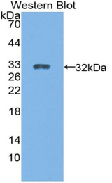 Western blot of recombinant CYP27B1.