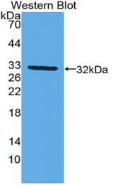 Western blot of recombinant CYP27B1.