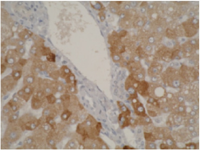 Left: Western blot of CYP2A6 antibody (LS-C27024) on recombinant cytochrome p450 at 1 ug/ml. Right: Staining using CYP2A6 antibody on normal human liver tissue at 1 ug/ml.