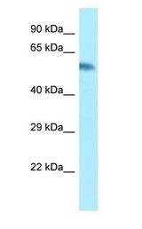 CYP2A6 antibody Western Blot of Fetal Small Intestine.
