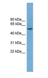 CYP2A7 antibody Western Blot of PANC1 cell lysate.