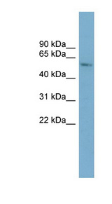CYP2A7 antibody LS-C107837 Western blot of ACHN lysate.