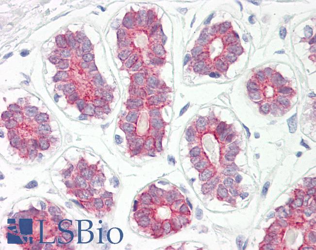 Anti-CYP2B6 antibody IHC of human breast. Immunohistochemistry of formalin-fixed, paraffin-embedded tissue after heat-induced antigen retrieval. Antibody LS-B8085 dilution 5-7.5 ug/ml.