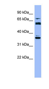 CYP2B6 antibody LS-B8085 Western blot of THP-1 cell lysate.